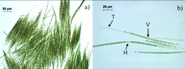 Algue AFA composition nutritive vue au microscope.