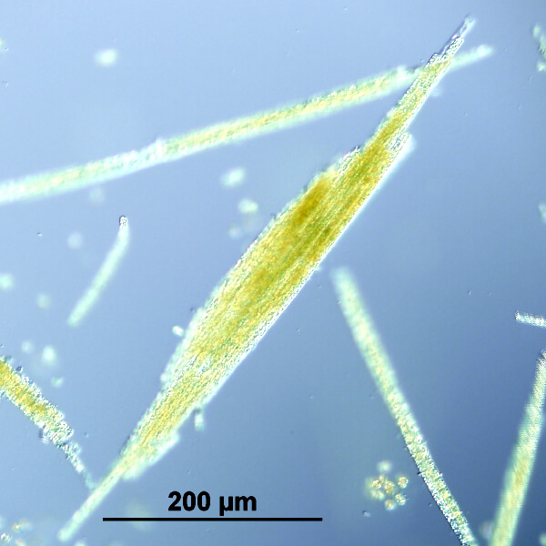 Vue au microscope de l'algue Aphanizomenon Flos Aquae de Klamath.