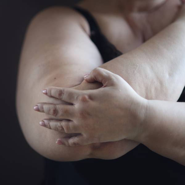 Gros plan sur le coude d'une femme en surpoids ayant une douleur articulaire.