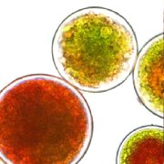Vue au microscope d'Haematococcus pluvialis, une micro-algue d'eau douce particulièrement connue pour être une riche source naturelle d'astaxanthine.