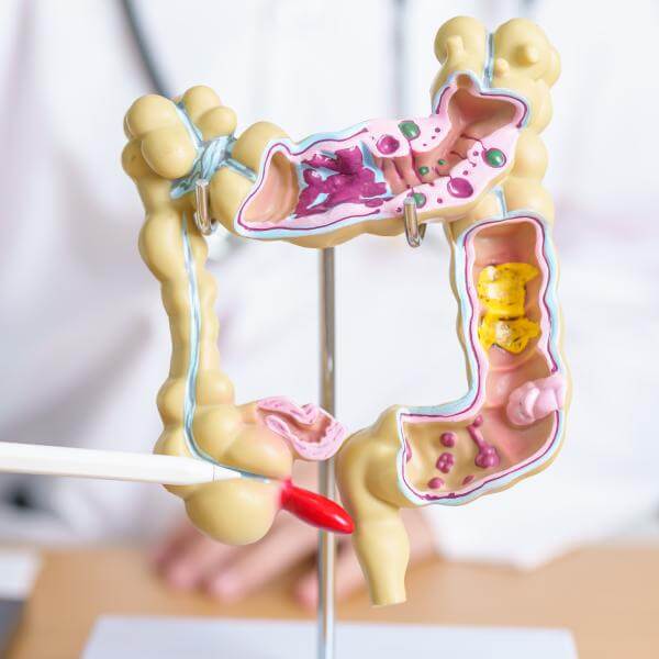 Un modèle d'intestin en plastiuqe présenté par un médecin.