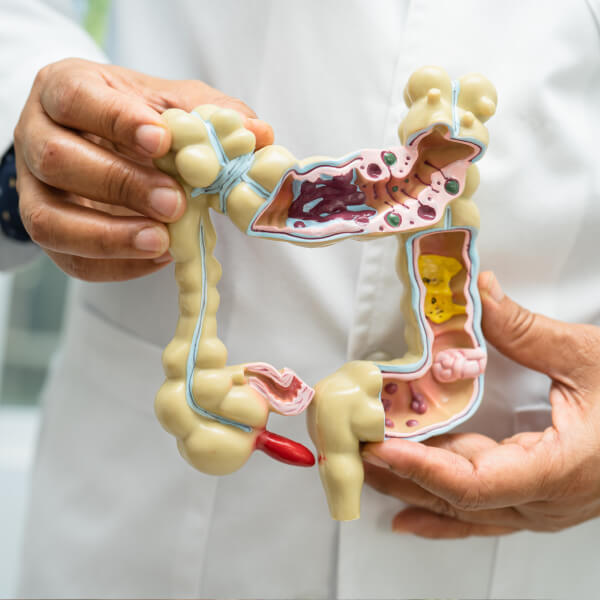 Un docteur tient entre ses mains un modèle d'intestin en plastique.