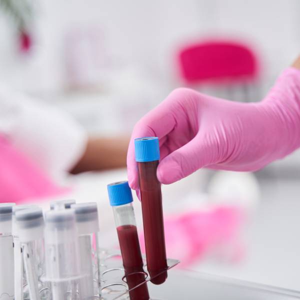 Un tube rempli de sang pour une analyse en laboratoire.