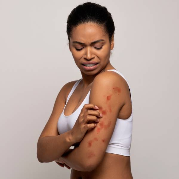 Une jeune femme observe avec frustration ses éruptions cutanées.
