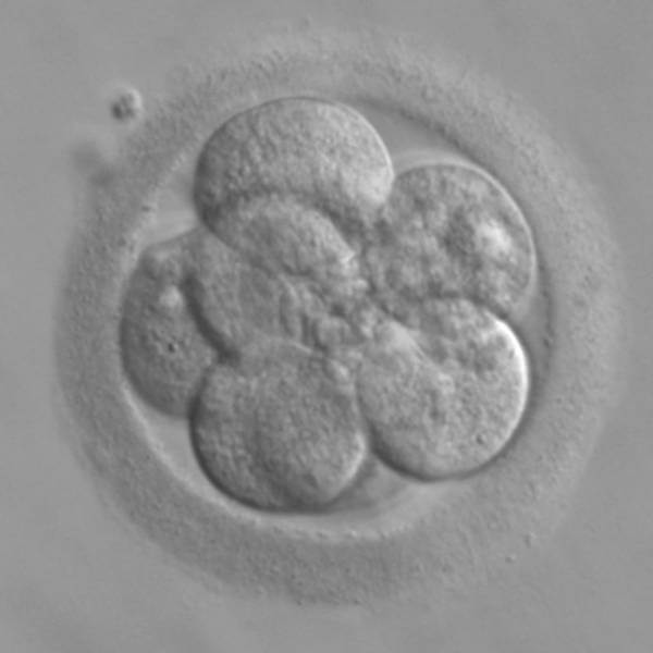 Un embryon humain de quelques jours utilisé pour le prélèvement de cellules souches.